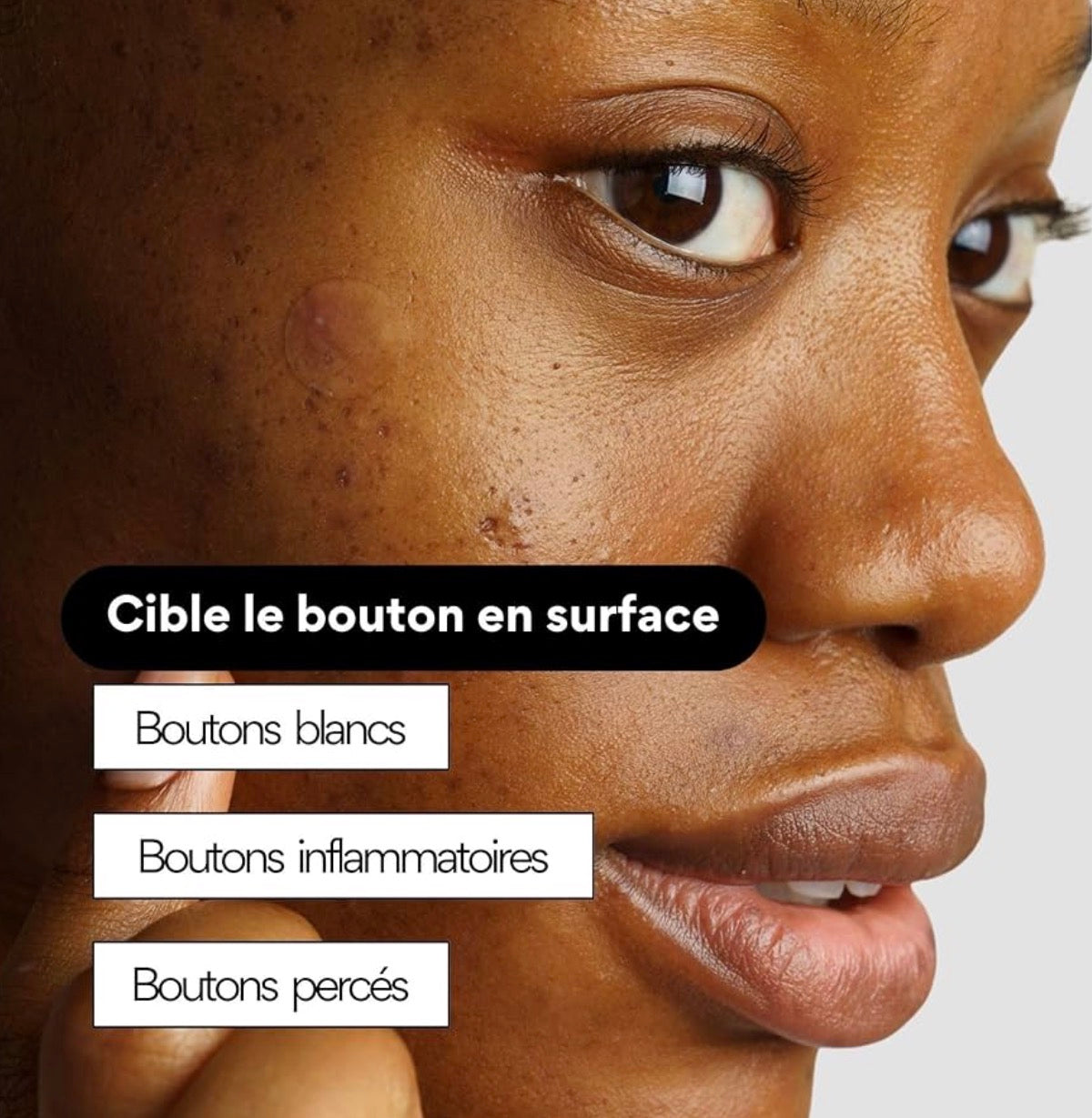 Acne Patch