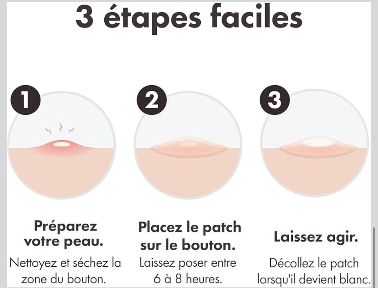 Acne Patch